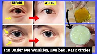 Only overnight! Eye rejuvenation. Get rid of under eye wrinkles, dark circles, eye bags, Crow's feet