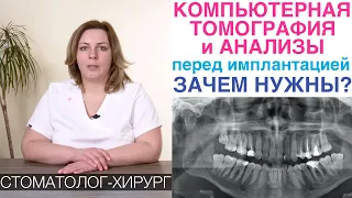 Имплантация зубов - зачем нужны компьютерная томография и анализы перед установкой зубного импланта?