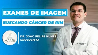 Câncer no rim: o que fazer? | Saiba como é feita uma biópsia renal | Dr. João Felipe Nunes