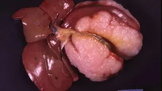 Gross Pathology of the Cat 4  - Liver and Pancreas