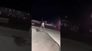 Worst Backflip Fail You’ll See! #scooter