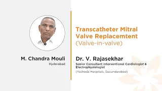 Transcatheter Mitral Valve Replacement (Valve-in-Valve) Surgery | Mr. Chandra Mouli