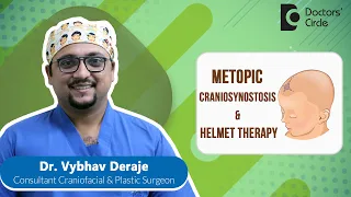 Triangular Forehead | Metopic Synostosis & Helmet Therapy #baby - Dr.Vybhav Deraje | Doctors' Circle