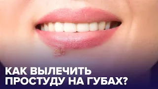 Как вылечить ПРОСТУДУ НА ГУБАХ? SOS-средства от герпеса