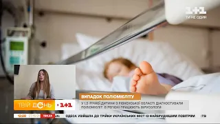 Випадок поліомієліту підтвердили у невакцинованої дитини з Рівненщини