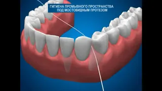 Гигиена полости рта, стоматологи и их настоятельные рекомендации по #гигиене