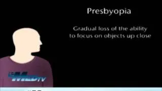 Presbyopia - Gradual Loss of Sight