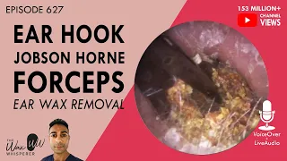 627 - Ear Hook, Jobson Horne & Forceps Ear Wax Removal