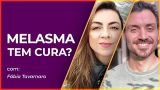 MELHORES E PIORES dicas para a sua pele | Melasma tem cura?