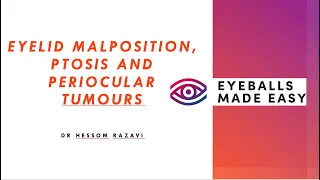 Eyelid malposition, ptosis and periocular tumours