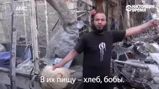 Ад в Алеппо: как выглядят те, кто выжил в бомбардировках