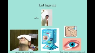 Disorders of the Eye Lid   CRASH! USMLE Step 2 and 3