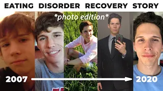 My Eating Disorder Recovery Story *PHOTO EDITION*