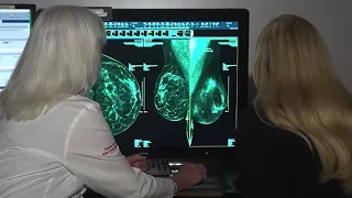 Artificial intelligence & early breast cancer detection