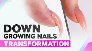 Down Growing Nails Transformation | Curved Nails | Polygel | Dual Forms