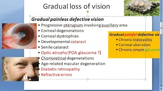 Ophthalmology Gradual slow loss of vision Painless Painful defective cause reason