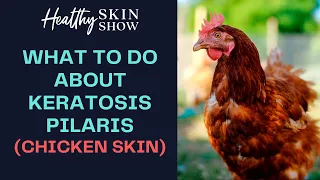 How To Get Rid Of KERATOSIS PILARIS Naturally! | Jennifer Fugo