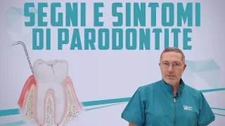 Sintomi precoci e tardivi della Parodontite | F.A.Q.