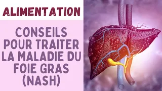 COMMENT TRAITER LA MALADIE DU FOIE GRAS / STÉATOSE HÉPATIQUE NON ALCOOLIQUE (NASH) ?👩‍⚕️