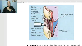 Anatomy for applied medical science(Radiology Department) 13 (Pleura , part 2), by Dr.Wahdan