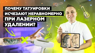 Почему татуировки удаляются НЕРАВНОМЕРНО???