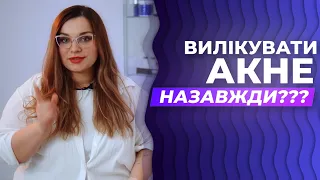 Як ВИЛІКУВАТИ АКНЕ назавжди?