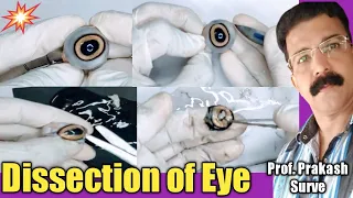 Dissection of Eye ( Structure of Eye - Detailed description with dissection ) By Prof. Prakash Surve