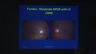 AIOC2019 - IC357 - Intravitreal injections in retinal practice- What every comprehensive ...