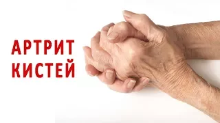 Что нужно знать об артрите кистей рук