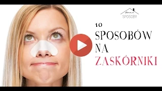 10 domowych sposobów na zaskórniki | Naturalne metody na wągry | cz.1