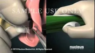 Nucleus Obstetrics and Gynecology OB GYN Demo