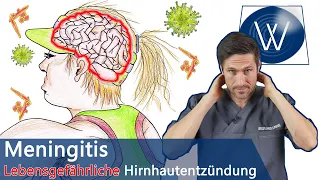 Lebensgefahr Meningitis ❗ Achten Sie auf diese Symptome - So gefährlich ist die Hirnhautentzündung!