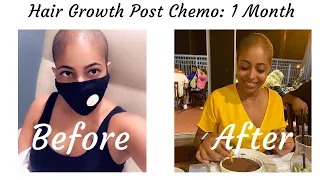 Natural Hairgrowth Post-Chemotherapy | Hodgkin's Lymphoma