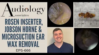 ROSEN INSERTER, JOBSON HORNE & MICROSUCTION EAR WAX REMOVAL - EP666