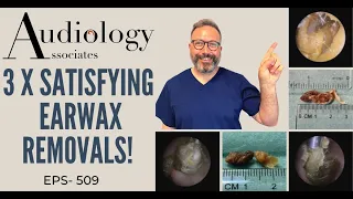 3 X SATISFYING EAR WAX REMOVALS - EP509