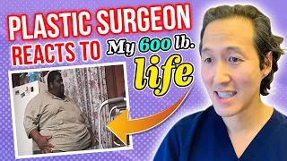One Man's Journey to Lose Hundreds of Pounds! A Doctor Reacts to MY 600 LB LIFE!
