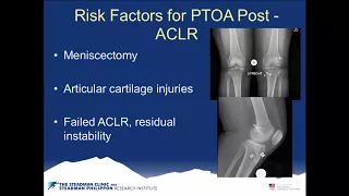 Knee Osteoarthritis Treatment and Symptoms | ACL Reconstruction Surgery Recovery| Minneapolis, MN