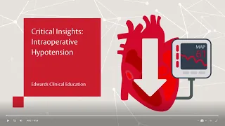 Critical Insights: Intraoperative Hypotension