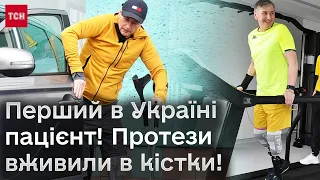 🦾 Капітан ЗСУ Ігор Крупнов втратив на війні ноги - протези йому вживили в кістки! І він пішов!