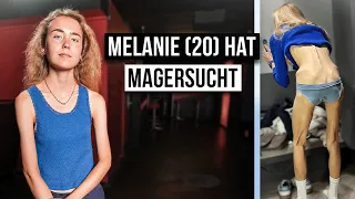 Wie ist das MAGERSÜCHTIG ZU SEIN?