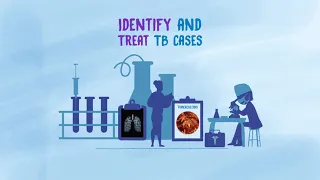 To end tuberculosis, we must find, treat and prevent it