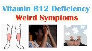 Vitamin B12 Deficiency Weird Symptoms (& Why They Occur)