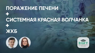 Поражение печени у пациента с системной красной волчанкой и желчнокаменной болезнью