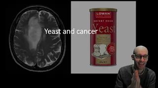 Hartwell's yeast, the cell cycle and cancer