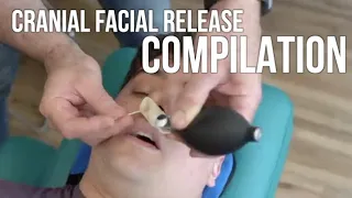 😱 CRANIAL FACIAL RELEASE COMPILATION 💥 FACE CRACKS