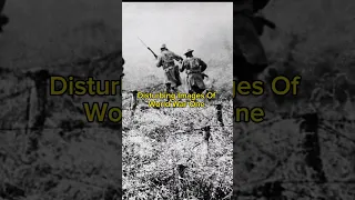 Disturbing Images Of World War One #ww1 #warshorts #military #warhistory #disturbing