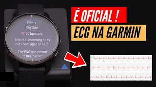 ECG da Garmin Já Está a Funcionar