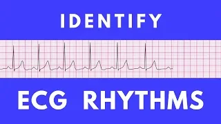Identifying ECG rhythms | ACLS Precourse