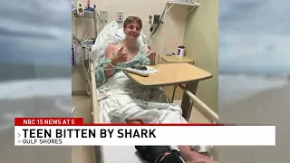 Teen bitten by shark in Gulf Shores - NBC 15 WPMI