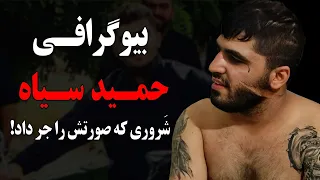 حمید مشکی از اشرار معروف تهران که خودش صورت خودش را جر داد!